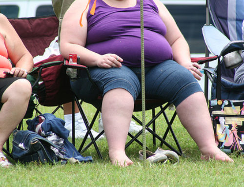 Obesity Predisposes to Severe Respiratory Failure