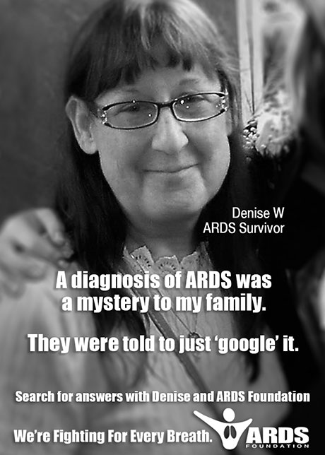 Denise ARDS Survivor